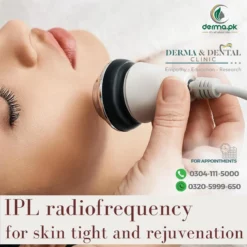 IPL Radiofrequency