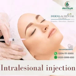 Precision Dermatological Care: Intralesional Injections at Derma & Dental Clinic