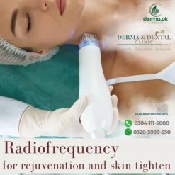 Radiofrequency