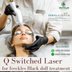 The Science of Q-Switched Laser: Advancing Freckle Treatment at Derma & Dental Clinic